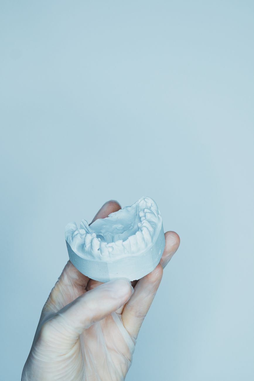 A gloved hand holds a plaster study model of a lower jaw, poured in dental stone.